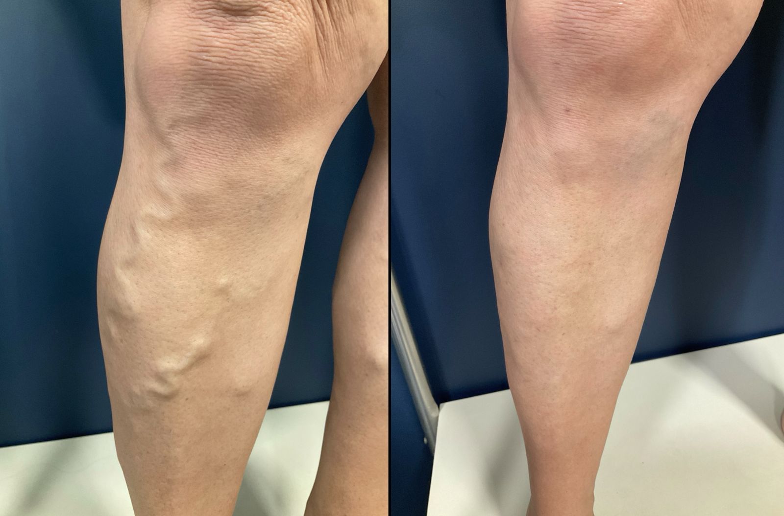 Vorher Nachher Vergleich 1